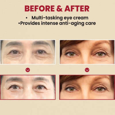 SEOUL 1988 Eye Cream : Retinal Liposome 4% + Fermented Bean 30ml