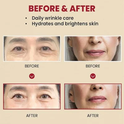 Seoul 1988 Cream Retinal Liposome 1% + Fermented Rice